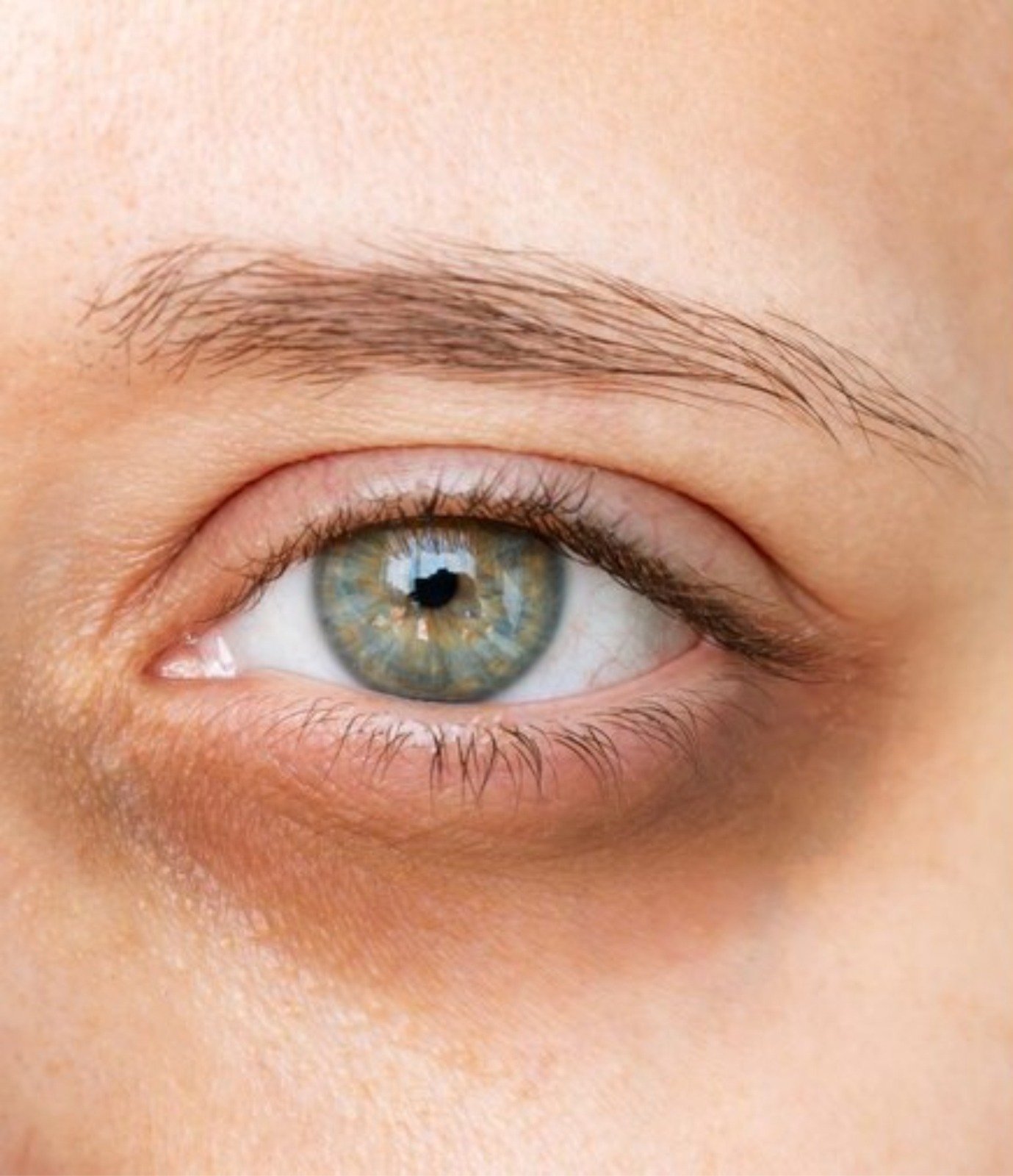 CAMUFLAGEM ESTÉTICA SE TORNA ALIADA NO RESGATE DA AUTOESTIMA